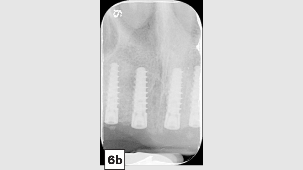 cm1403-lighting-esthetic-zone-06b
