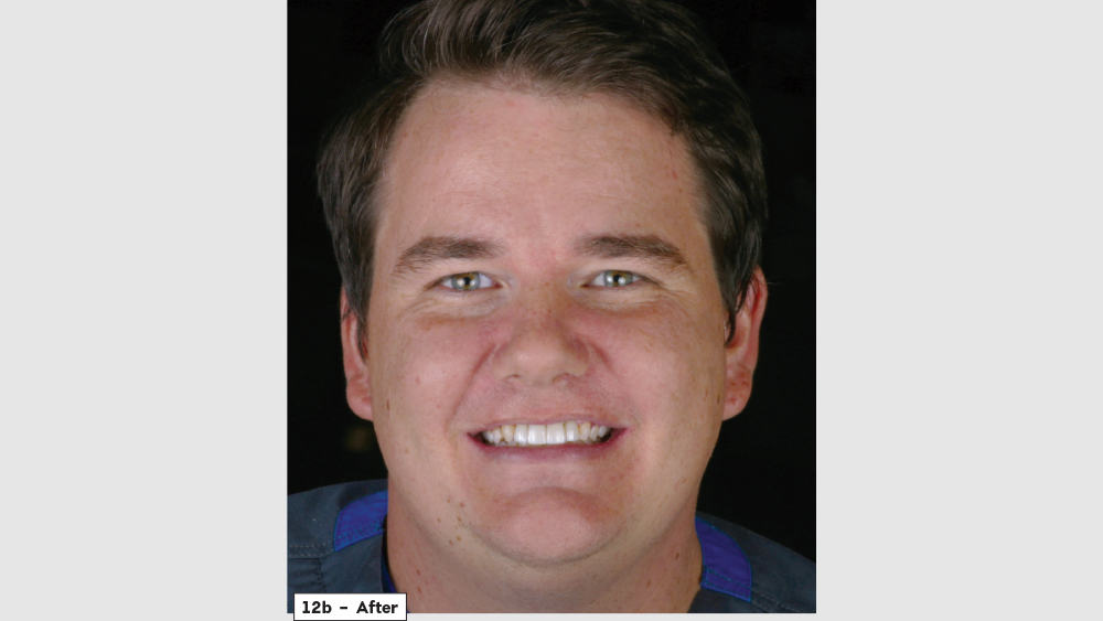 cm1403-lighting-esthetic-zone-12b