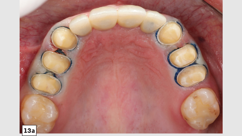 cm1403-lighting-esthetic-zone-13a