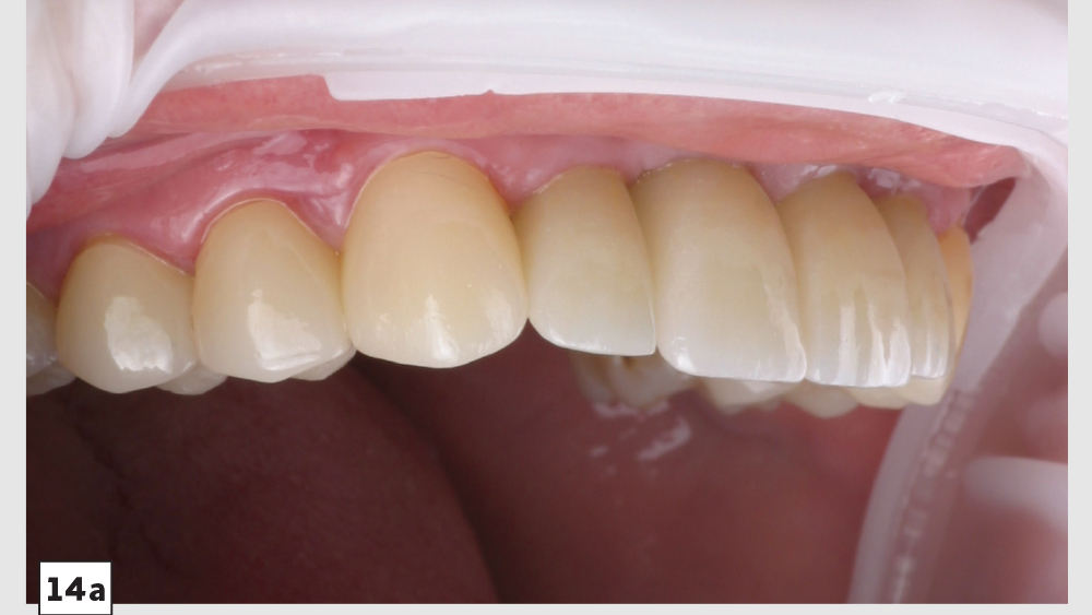 cm1403-lighting-esthetic-zone-14a