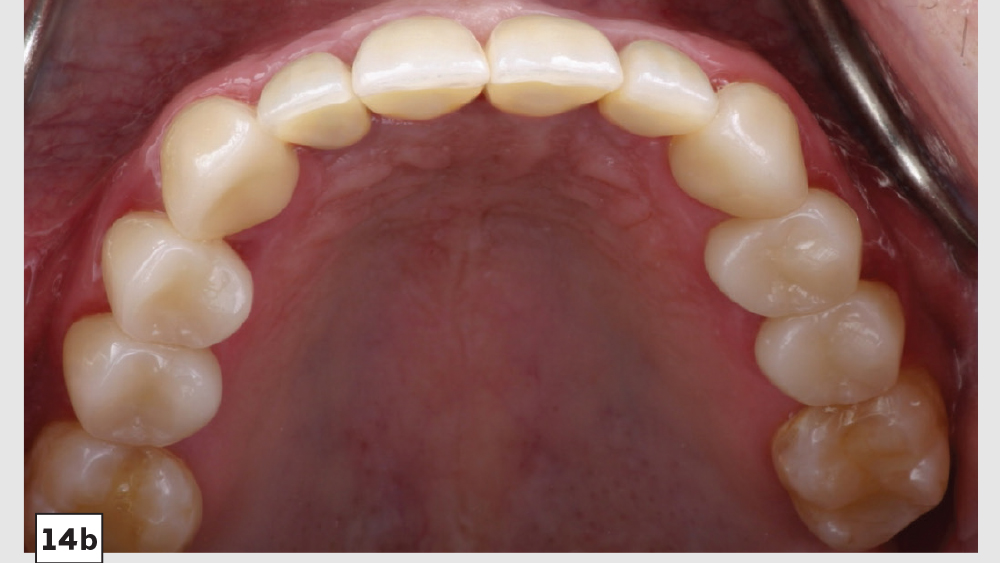 cm1403-lighting-esthetic-zone-14b