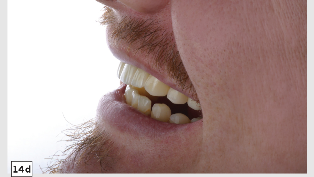 cm1403-lighting-esthetic-zone-14d