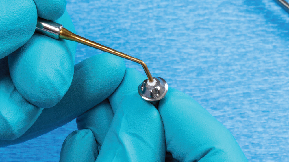 figure 7: RelyX Unicem is used to cement the crow to the custom abutment