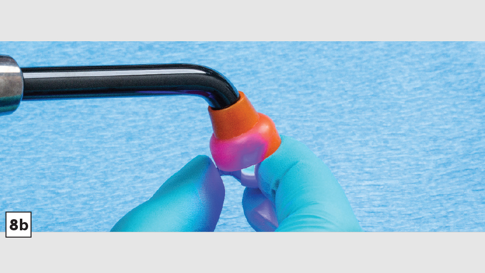figure 8b: after light-curing begins on the screw