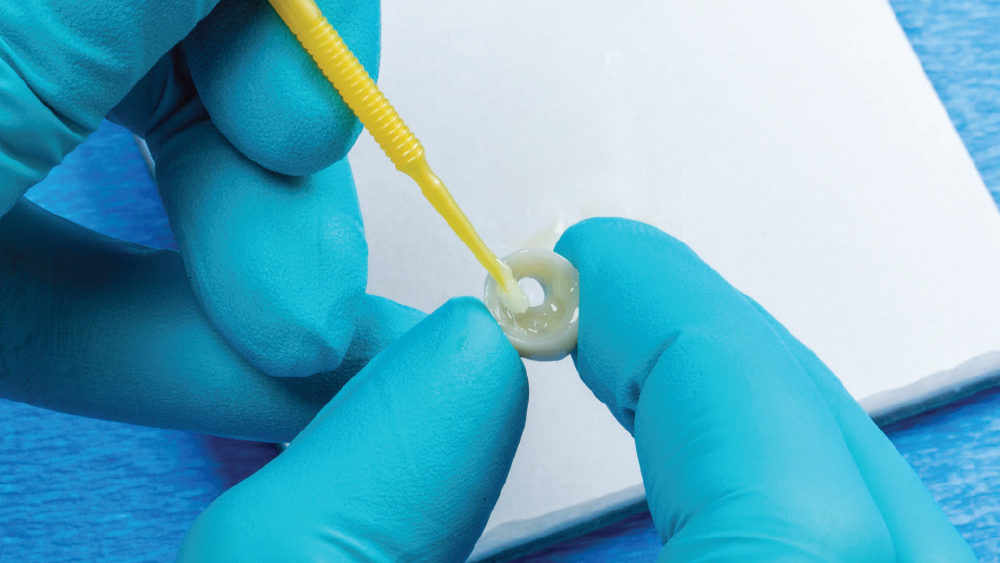 figure 6: teflon tape used to cover screw access channel 