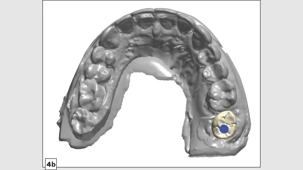 figure 4b: digital design of ideal emergence profile