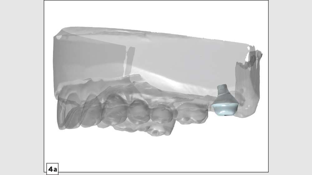 figure 4a: digital design of ideal emergence profile