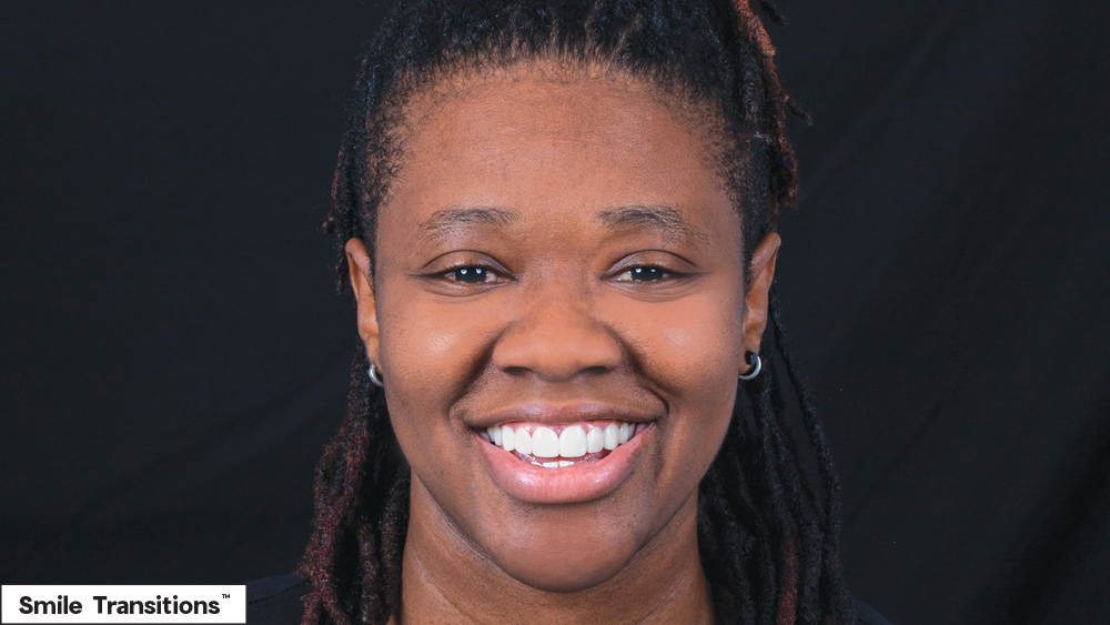 Patient after Smile Transitions