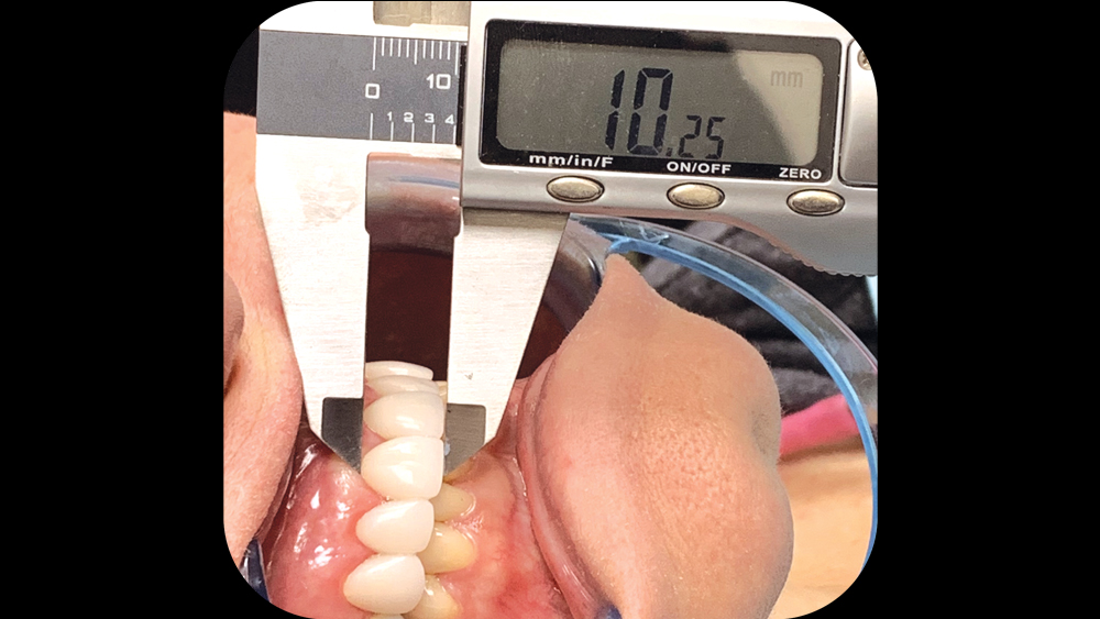 predictable results for the BioTemps Provisionals