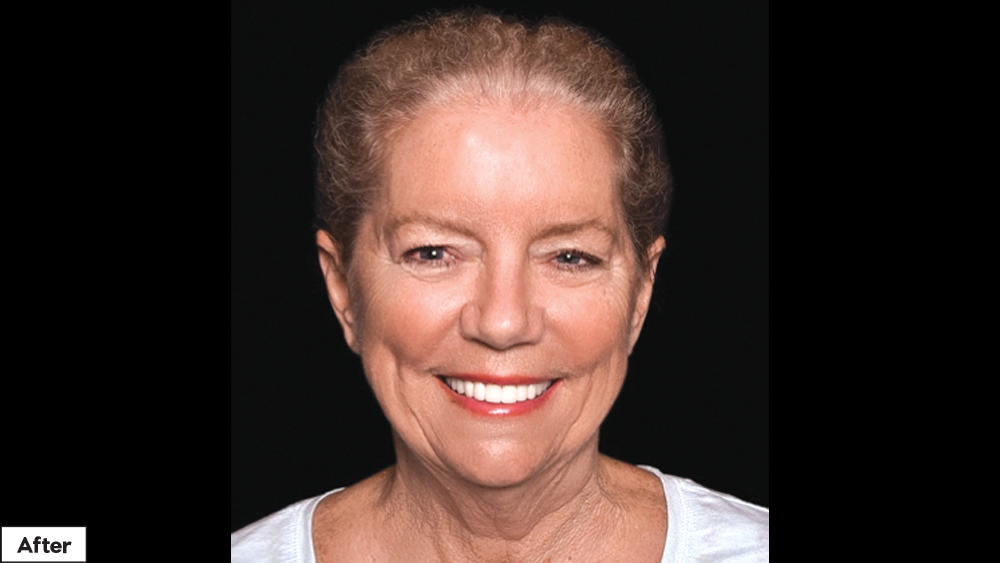 BioTemps Provisionals