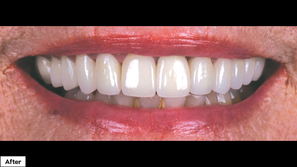 BioTemps Provisionals