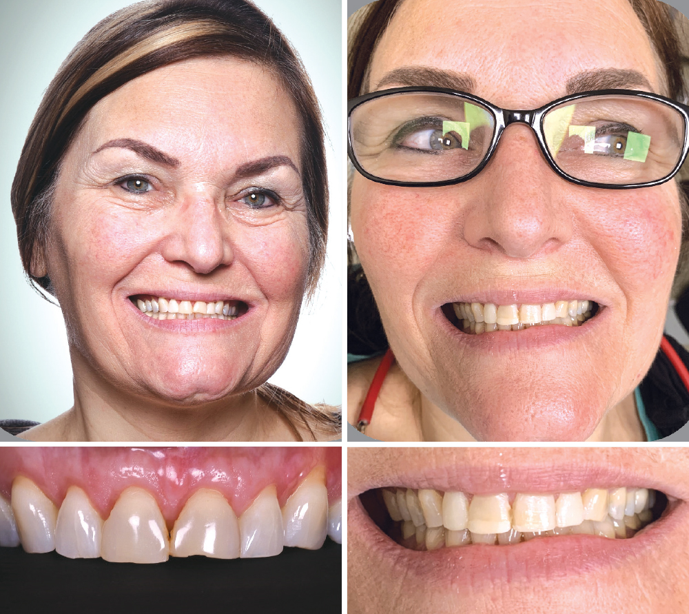 CREATING LONGER CENTRALS