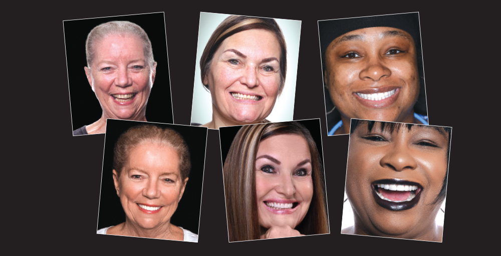 Esthetic Provisionals: Now More Than Ever