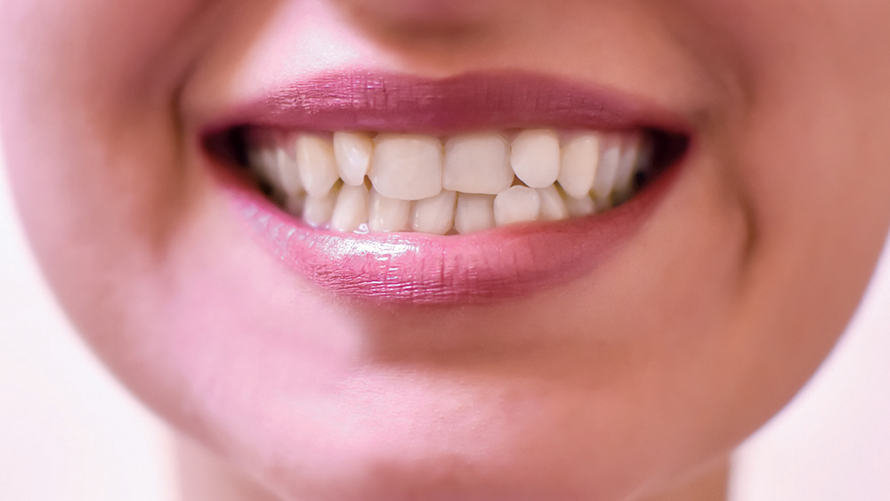 Malocclusion and space management