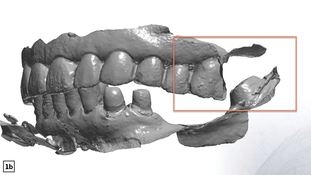 Full complete and accurate impression captured