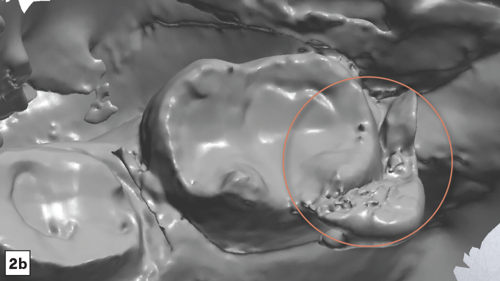 Droplets in 3D image of the dentition