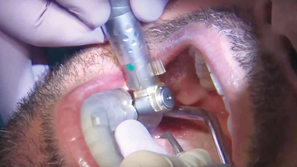 Guided-Surgery-case-photo CSM 15.1