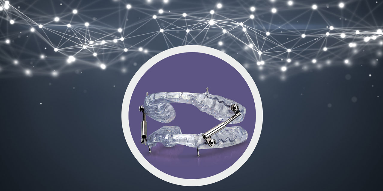 OASYS Hinge Appliance™