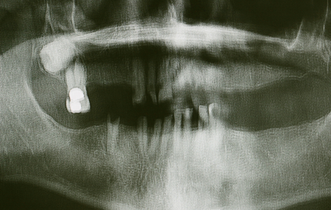 Hahn Clinical Case Image 1 CSM V15I2