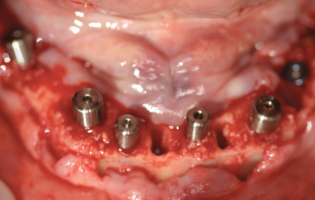 Hahn Clinical Case Image 2 CSM V15I2