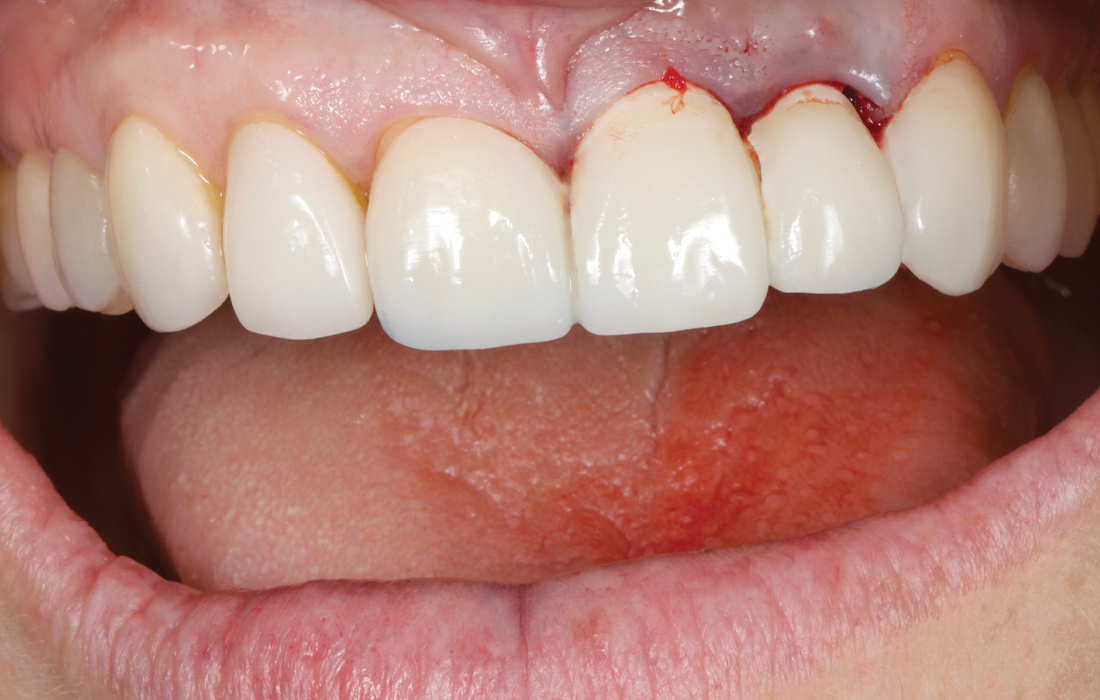 BioTemps Provisionals