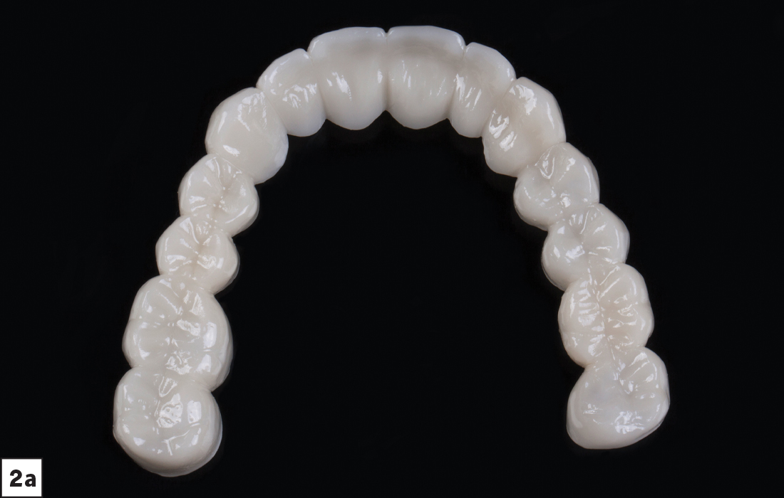 Patient visualize what his completely transformed smile could look like