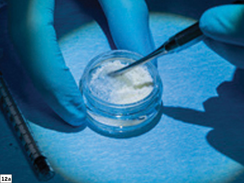 Newport Biologics Mineralized Cortico/Cancellous Allograft Blend