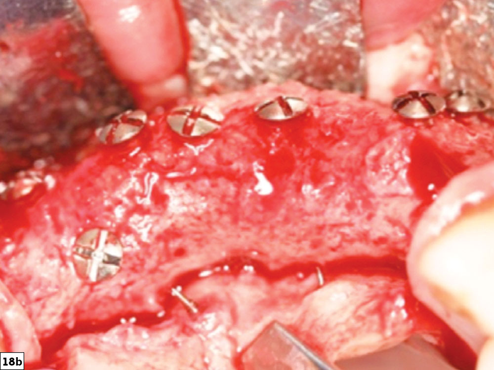 Bone growth post-healing image