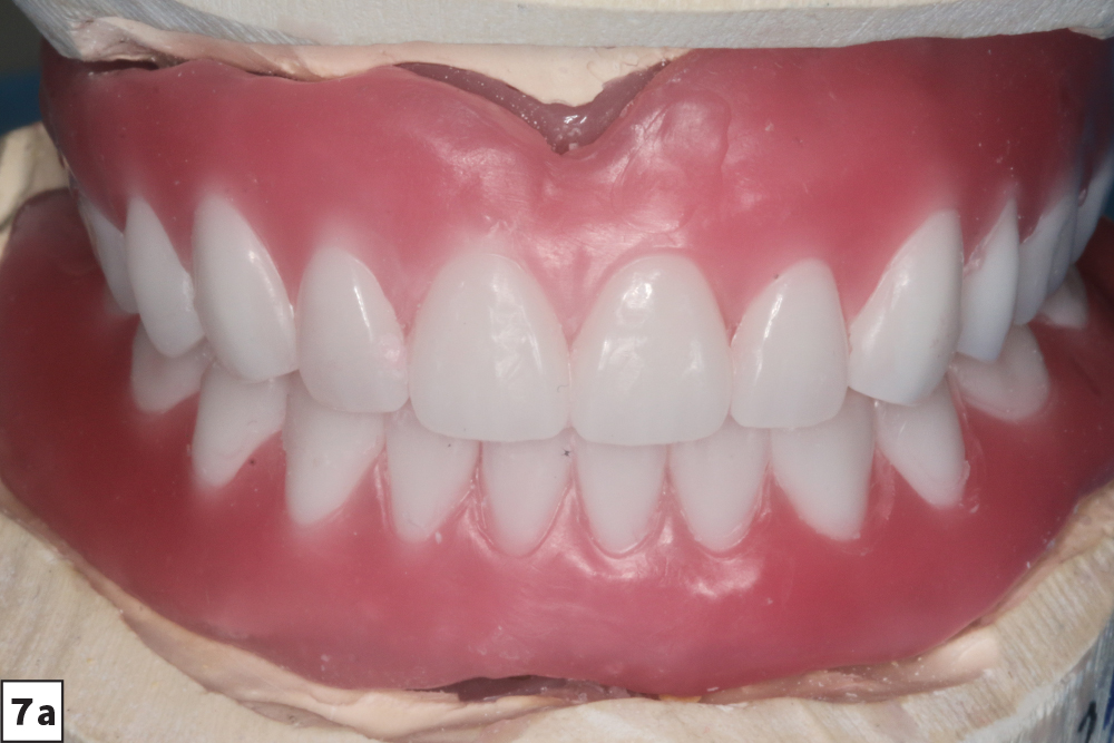 Figure 7a - Wax setups - V15I2