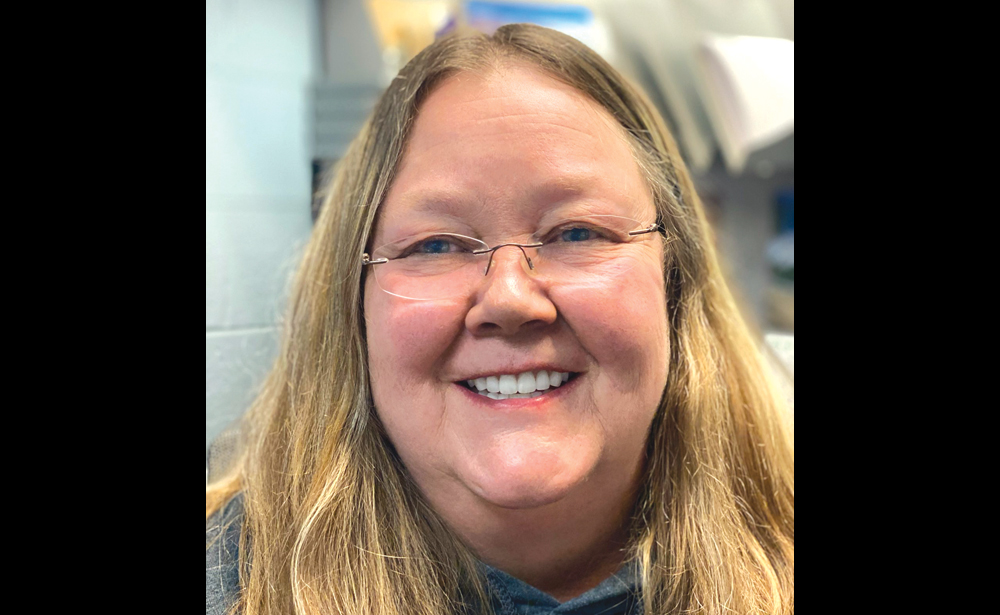 Figure 11 - Final patient smile with stabilized overdentures - V1512