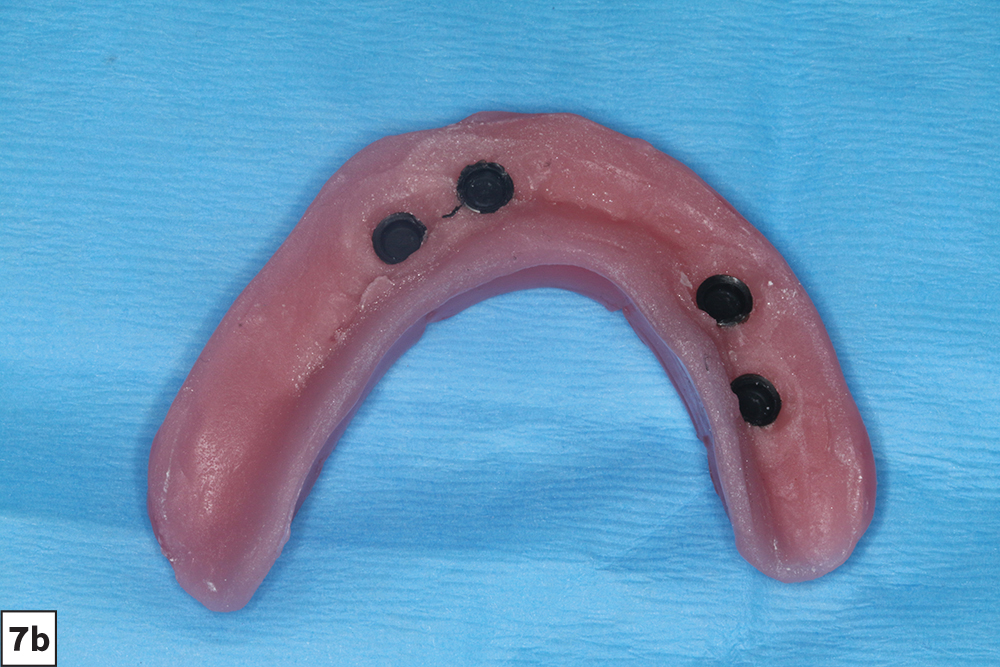 Figure 7a - Wax setups - V15I2