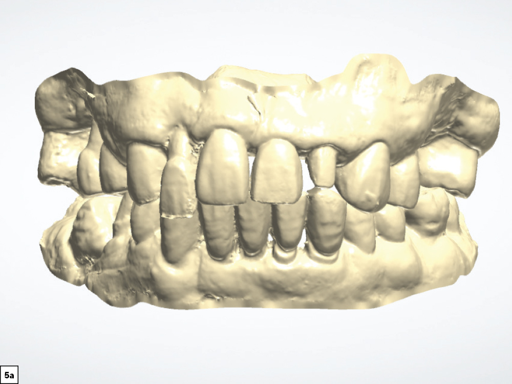 Figure 5a 3D CSMV16I1