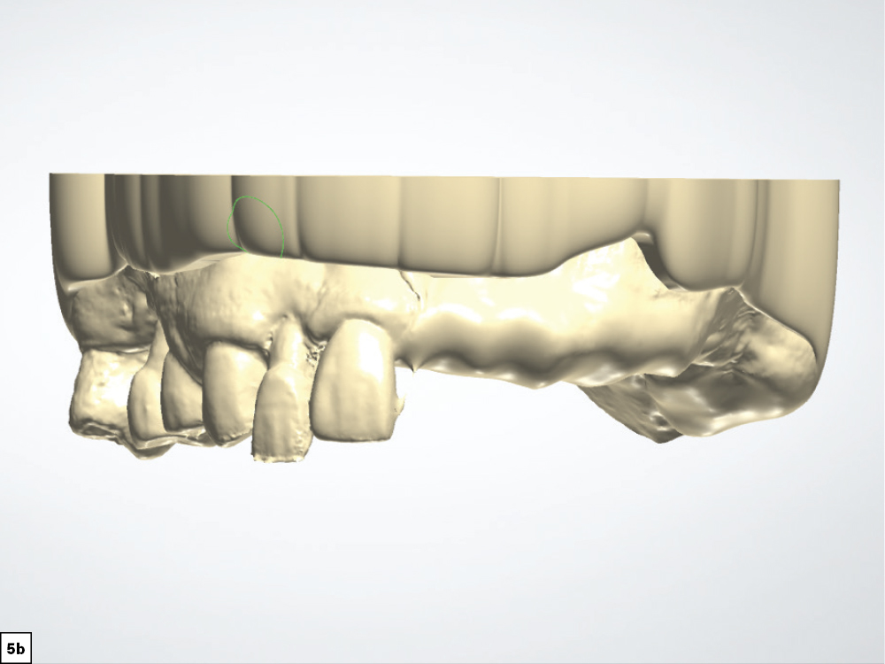 Figure 5b 3D CSMV16I1