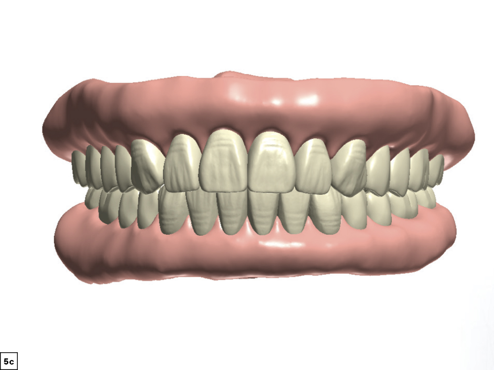 Figure 5c 3D CSMV16I1