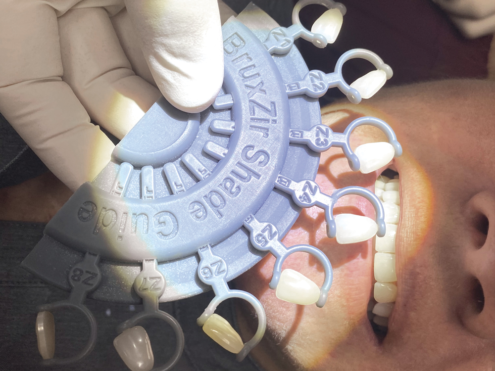 BruxZir Zirconia Shade Guide