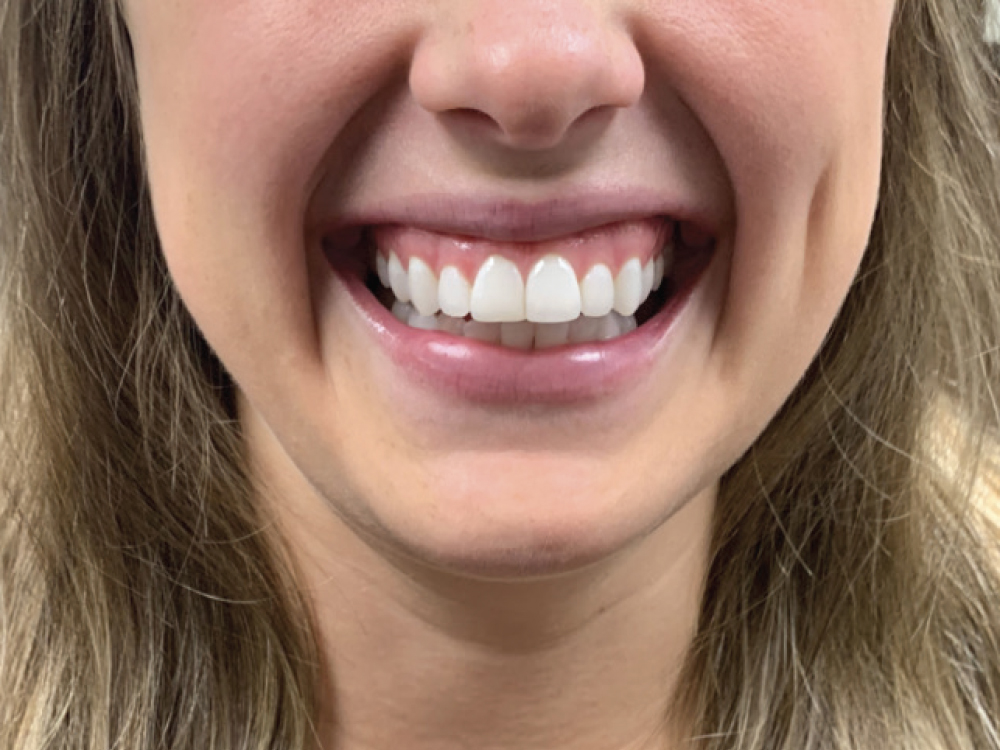 Gummy Smile CSM V16I1 Interview Dr. Sheehan