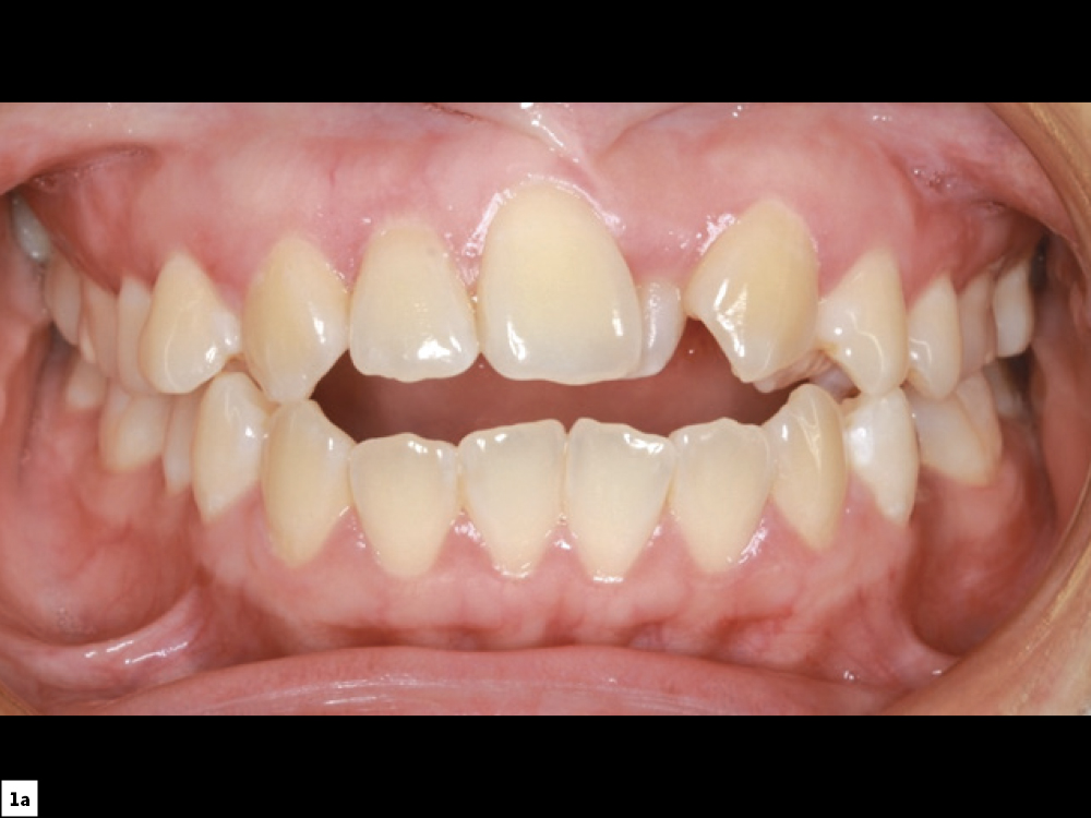 Figure 1A CSM V16I1 A Multidisciplinary Approach for the Best Esthetics