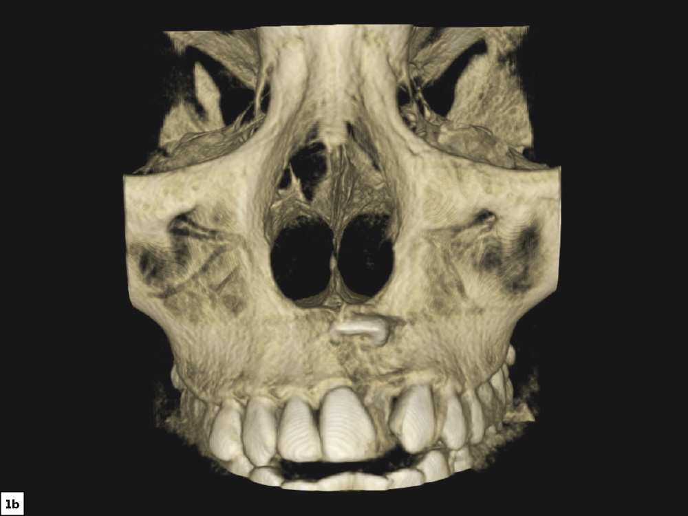 Figure 1B CSM V16I1 A Multidisciplinary Approach for the Best Esthetics