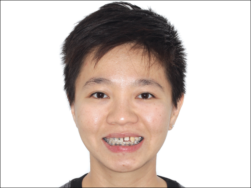 Figure 2 CSM V16I1 A Multidisciplinary Approach for the Best Esthetics