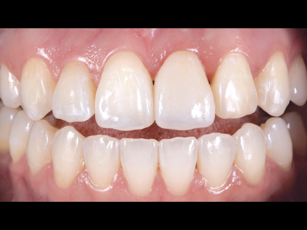 Figure 9 CSM V16I1 A Multidisciplinary Approach for the Best Esthetics