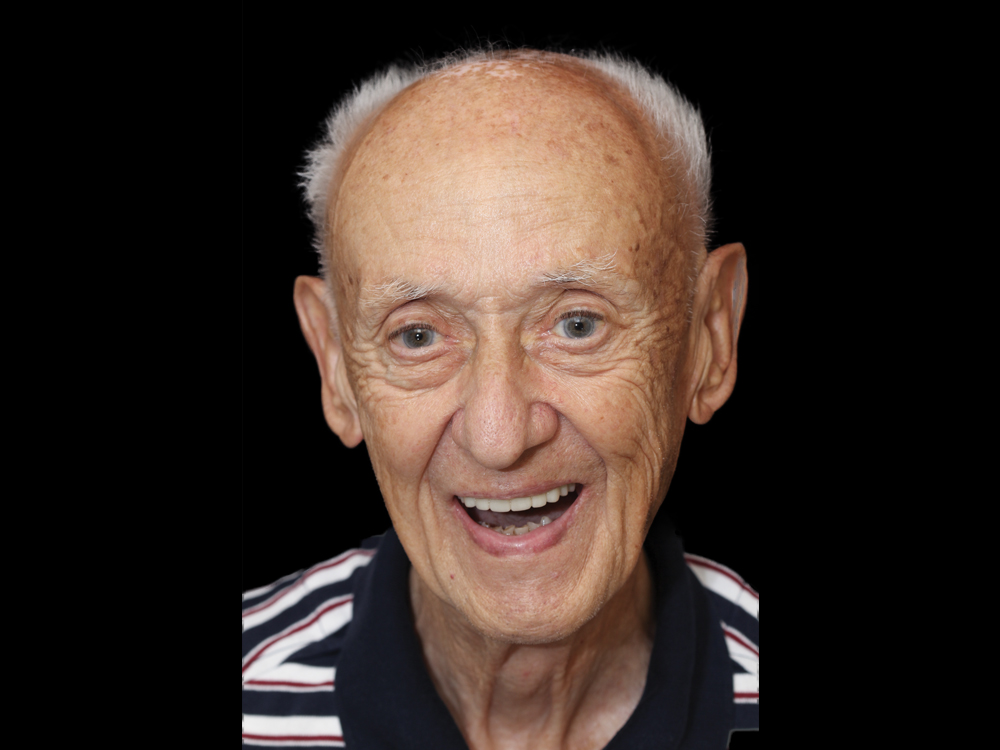 Dr. Nosti first full-arch implant case 1 CSMV16I1