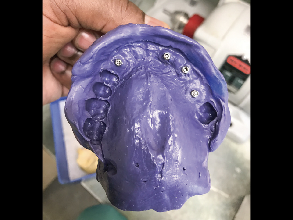 1 month later - preliminary impression was created