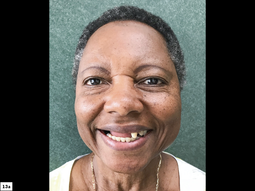 Patient's face before transformation