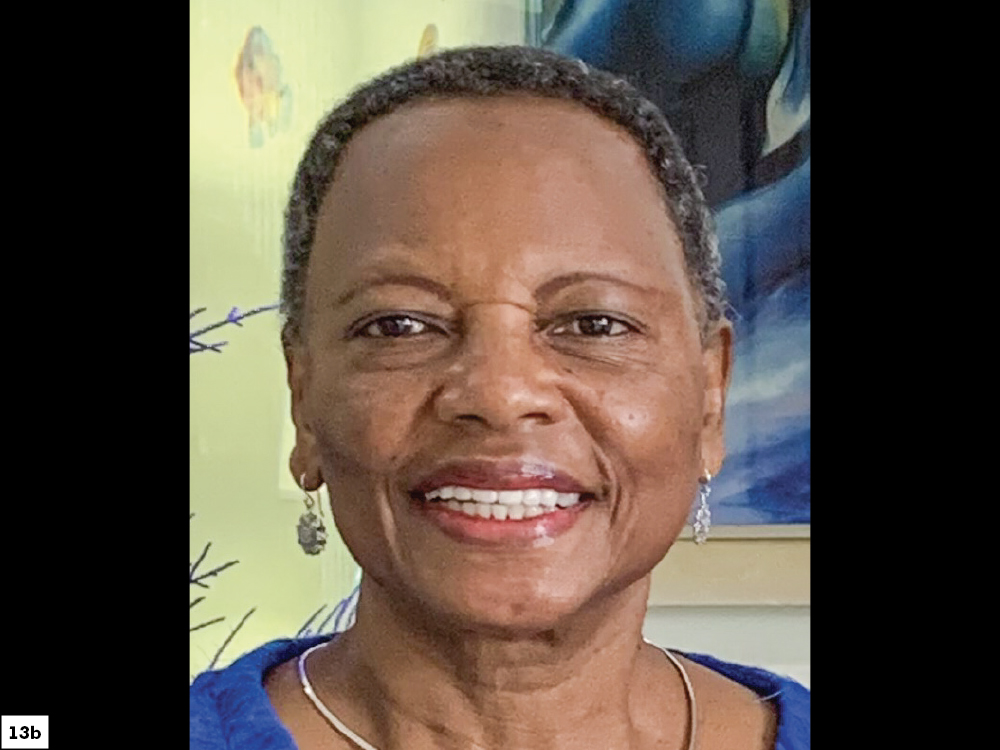 Patient's face after transformation