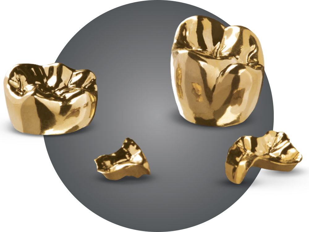 Average full-cast gold restoration per-unit price