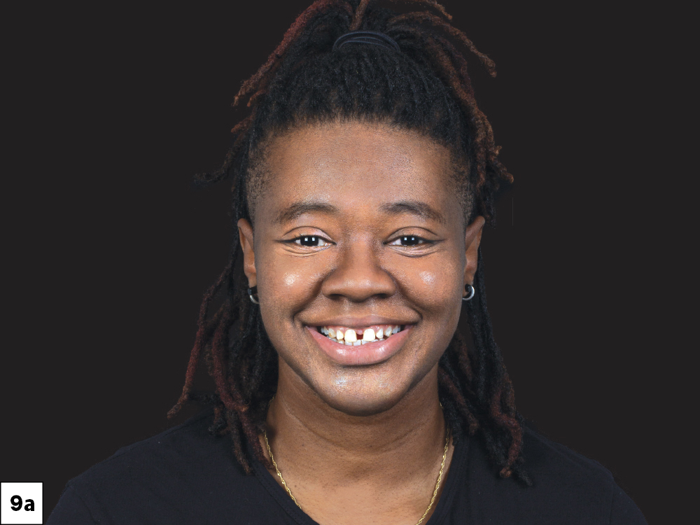 Supporting Long-Term Soft-Tissue Health: Figure 9a