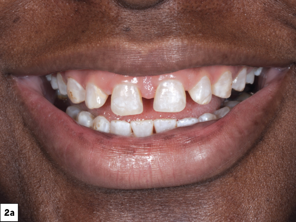 Supporting Long-Term Soft-Tissue Health: Figure 2a