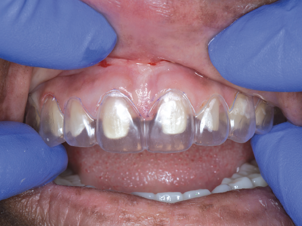 Supporting Long-Term Soft-Tissue Health: Figure 4