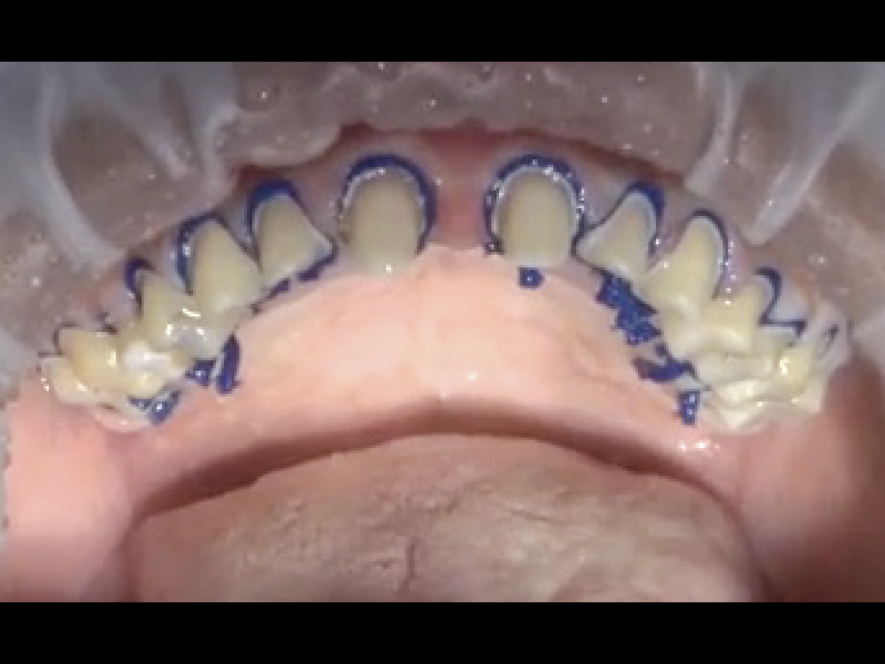 Supporting Long-Term Soft-Tissue Health: Figure 7