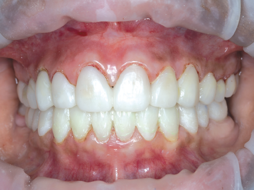 Supporting Long-Term Soft-Tissue Health: Figure 6